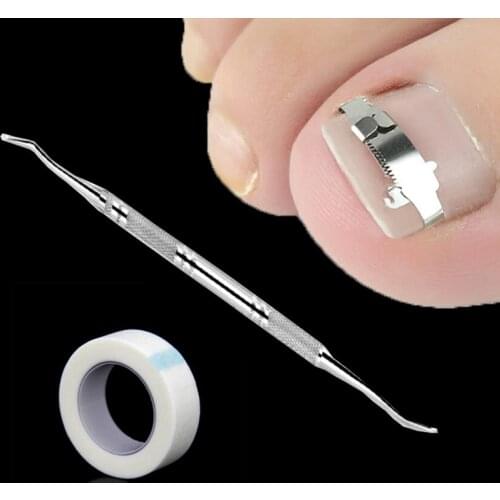 3pcs/set Stainless Ingrown Foot Care Tool Toe Nail Fixer Pedicure Recover Embed Toenail Correction Lifter Tool Kit Inset Buckle