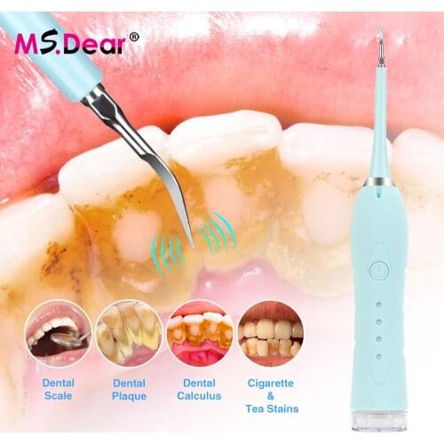 Electric Calculus Remover Teeth Whitening Cleaning Dental Tartar Scraper Tooth Polisher Stain Eraser High Frequency Vibration