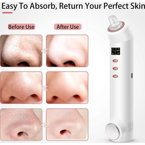 Blackhead Remover USB Rechargeable Face Nose Pore Vacuum Cleaner with Hot/Ice Compress LED Display 4 Levels 2 Probes EK