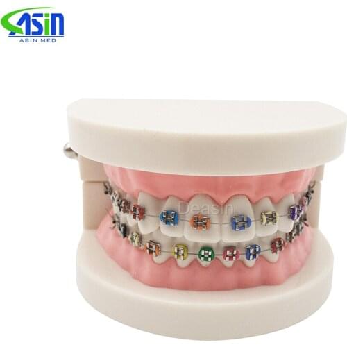 Orthodontics Model for Dentist Dental 1/2 Standard Dentition with Full Metal Brackets Teeth Model