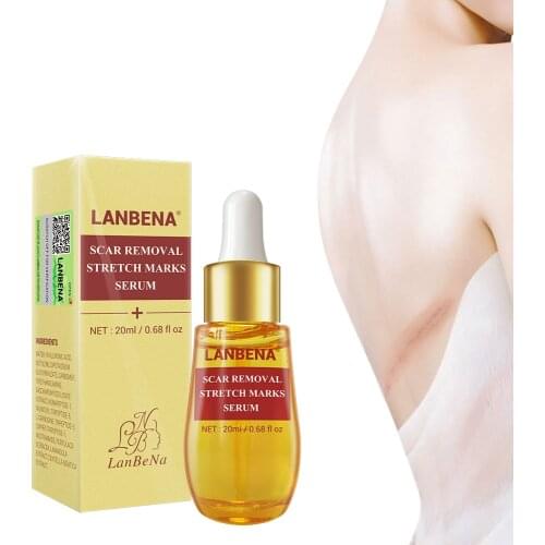LANBENA Acne Scar Remove Serum Acne Treatment Remover Stretch Marks Anti Acne Shrink Pores Blackhead Whitening Cream Skin Care