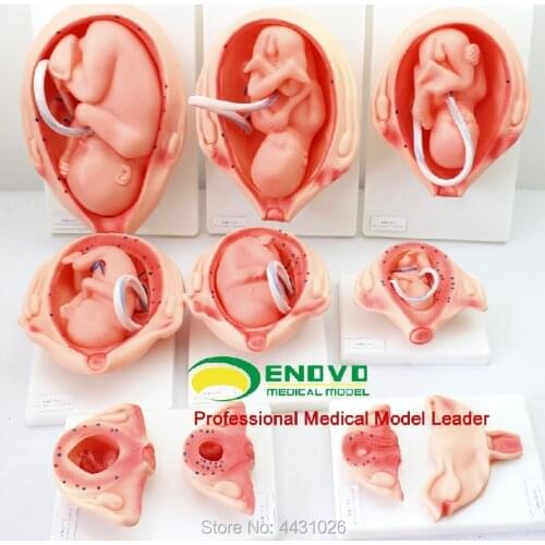 ENOVO Fetal development model of fetal development model 10 parts family planning