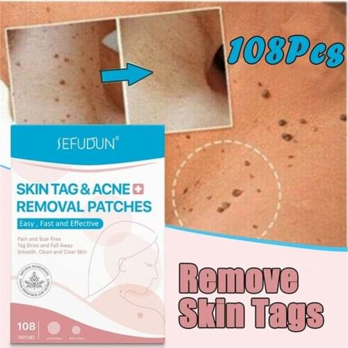 Skin Tag Remover Patch Ance Pimple Patch Plaster Acne Cream Invisible Hydrocolloid Pimple Master Anti-infection Absorb Body Care