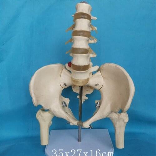1:1 Disc herniation 1: 1 pelvis lumbar vertebra sacrum femur Model Lumbar disc nerve bones Skeleton medical teaching