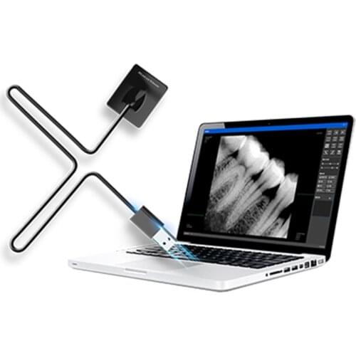 Factory price portable x-ray degital rvg sensor usb