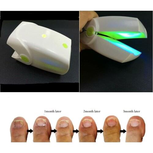 Rechargeable Nail Fungus Laser Treatment Device Cure Onychomycosis Professional Toe Finger Nail Fungus Treatment Machine