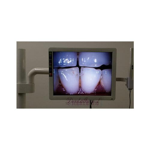 2019 High Quality Dental 8-LED Intraoral Camera with 17" LCD Monitor and Dental Mount Holder Computer