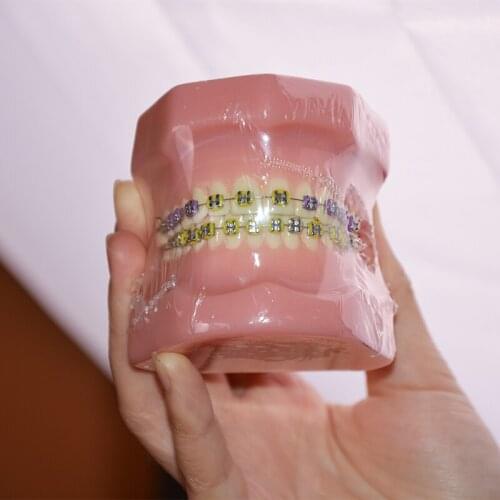 B3-01 Orthodontic Dental Typodont Teeth Model with Fully Metal Bracket High Quality Dental Orthodontic Model With Teeth Brackets