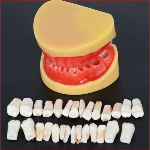 Dental All teeth Removable Standard Teeth Tooth Model 28 pcs teeth student learning model