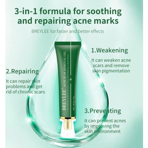 BREYLEE Scar Removal Gel 30g Facial Acne Scar Pimple Repair Essential Oil Repair Acne Mask Acne Treatment Face Serum
