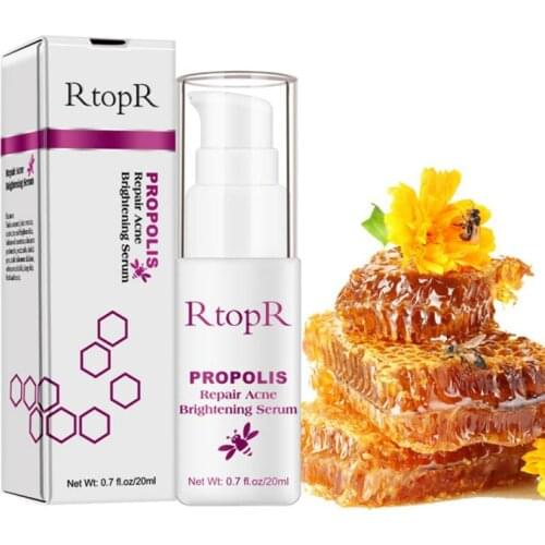 Face Care Cream Skin Repairing Acne Cream Oil Control Acne Remover Care Shrink Pores Scar Whitening Moisturizer Skin TSLM1