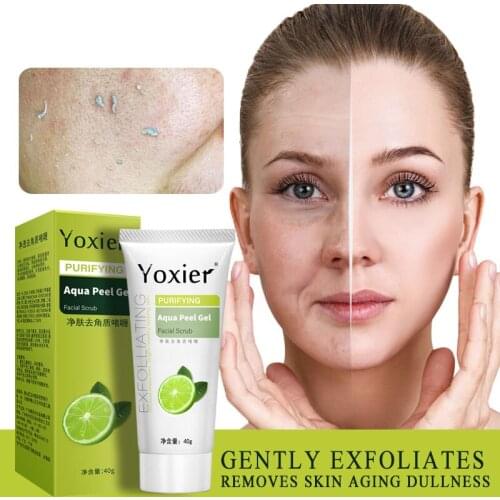 1pcs Exfoliating Face Scrub Peeling Gel Moisturizing Whitening Lemon Vitamin C Remove Acne Detoxifies And Cleanses All Skin