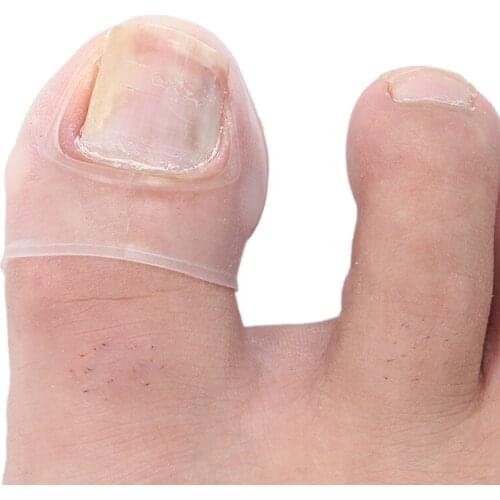 2Pcs Ingrown Pads Nail Silica Gel Groove Orthopedic Pads Nail Correction Devices New