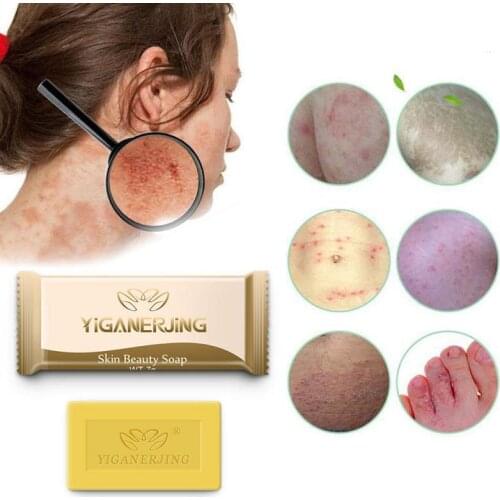 1PC Sulfur Soap Anti Fungus Bath Soap Anti-mite Soap Skin Cleaning Acne Seborrhea Skin Care Anti Fungus Soap Portable Clean