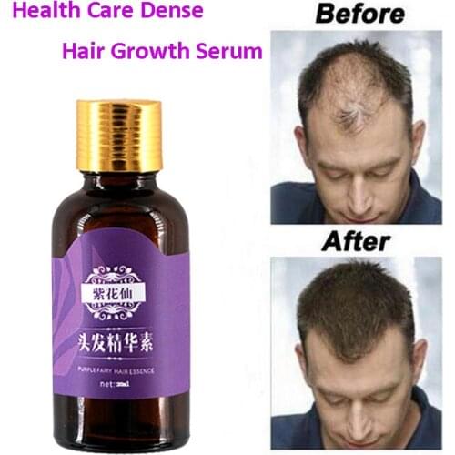 20ML Plant Serum Hair Growth Essential Oils Essence Original Authentic 100% Hair Loss Liquid Health Care Dense Hair Growth Serum