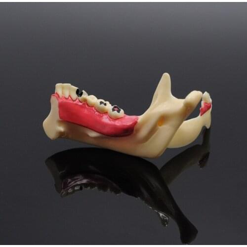 Dentist Lab Mandibular Model for Dental Communication Model Dental Teaching Training Model