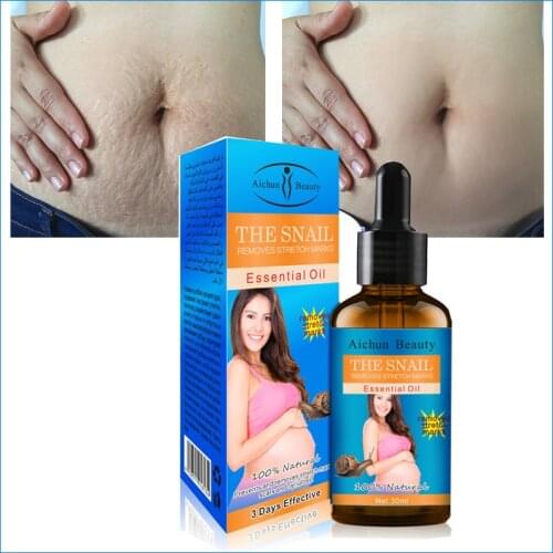 Stretch Mark Repair Oil Nourishing Body Skin Quickly Remove Stretch Marks Mommy Body Repair Snail Essential Oil 30ml