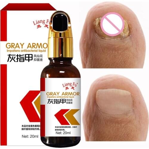 New Nail Fungal Nail Repair Essence Serum Treatment Care Foot Nail Fungus Removal Gel Anti Infection Paronychia Onychomycosis