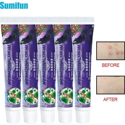 Sumifun 5pcs Psoriasis Ointment Antibacterial Cream Skin Care Product Dermatitis Eczema Treatment Itching Medical Plaster D3469