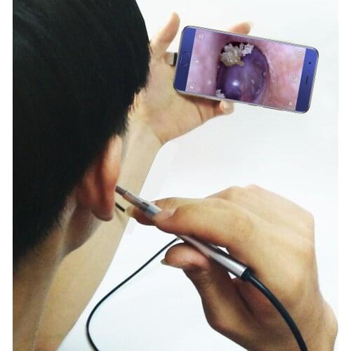 Borescope 3 in 1 Ear Cleaning 3.9MM Childrens Otoscope Otoscope Inspection Camera with 6 Adjustable LEDs for PC USB-C Android