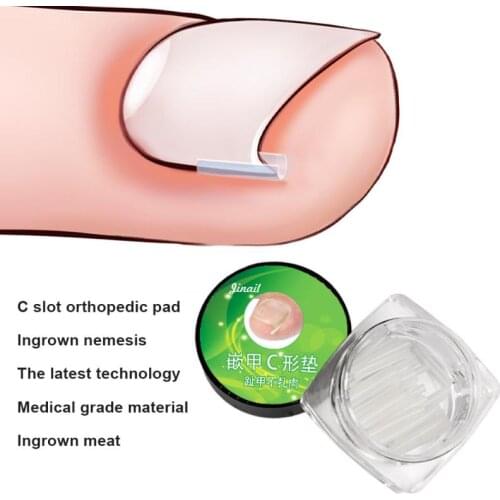 10pcs/set Ingrown Pads Nail Groove Orthopedic Pads Nail Correction Devices Correction Treatments Sticker Patch Foot Care Tools
