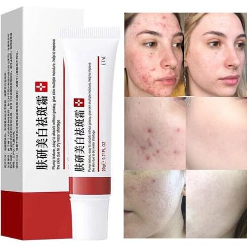 20g Whitening Acne Cream Effective Anti Acne Scar Cream Freckles Acne Blackhead Scar Dark Spots Skin Whitening Skin Care