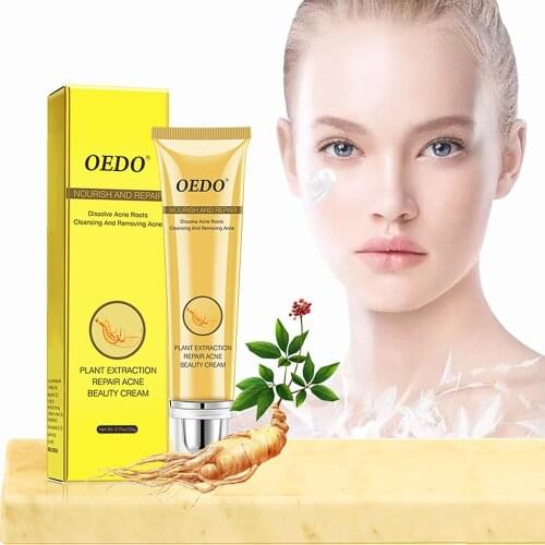 Acne Treatment Face Cream Fade Spot Oil Control Shrink Pore Whitening Moisturizing Whelk Cream Women Beauty Skin Care Cream