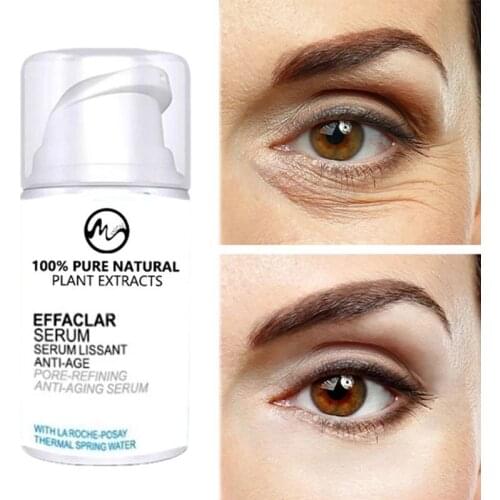 Minch Instant Remove Eye Bags Cream Anti Puffiness Gel Remove Dark Circles Eye Cream Delays Anti-Aging Anti Wrinkles Firming