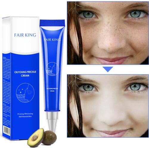 20g Freckle Removal Cream Dark Spot Skin Pigmentation Age Spots Skin Whitening Cream can CSV