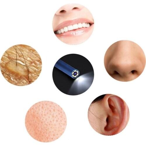 3 in 1 Ear Wax Removal Tool,USB Otoscope-Ear Scope Camera In Ear Cleaning Tool