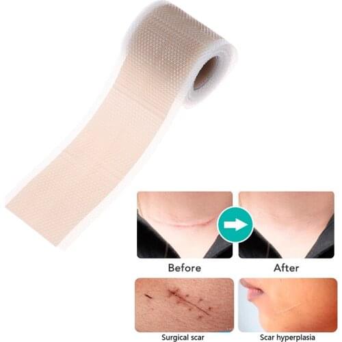 1Roll Silicone Gel Scar Removal Efficient Beauty Silicone Gel Self-Adhesive Silicone Gel Tape Patch For Acne Burn Scar Reduce