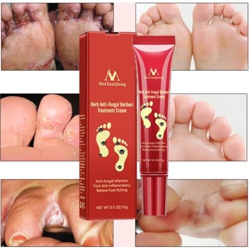 Гели для ног SI MI DA DANG China At AliExpress