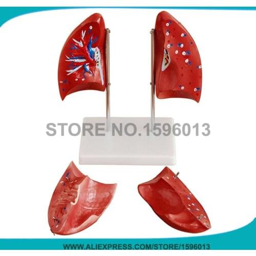 4 parts Detachable Lung model Human Lung AnatomyModel