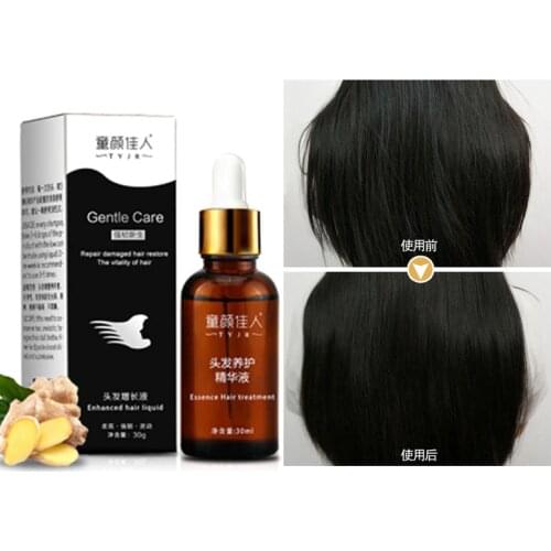 30ml better than Andrea Fast Growth Essence Yuda Pilatory Ginger Shampoo Anti Gray Loss Liquid Damaged hair serum treatment
