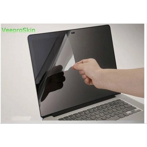 3pcs Matte Blu-ray Notebook Screen Film laptop for Apple MacBook Pro 15 A1990 A1707 15.4 Retina Display Screen Protector