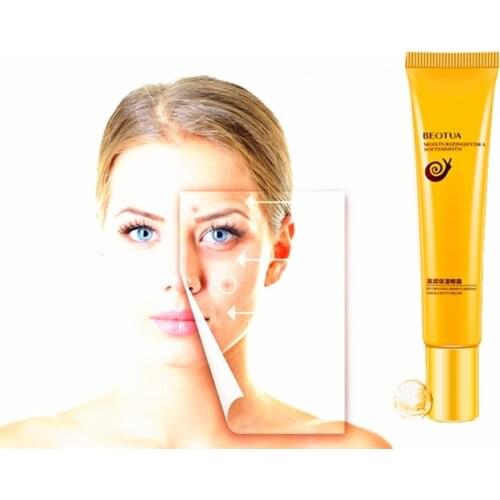 Against Ageing Eye Cream Anti-aging Anti-puffiness Snail Collagen Eye Creams Remove Eye Bag Dark Circle Whitening Pigment Spots