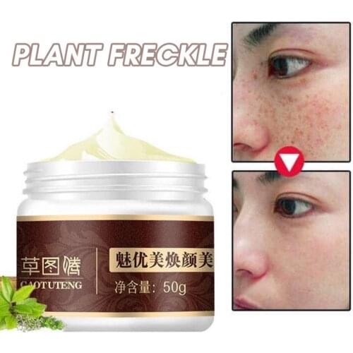 Freckle Cream Whitening Cream Treatment Face Cream Anti Freckle Collagen Moisturizer Original Remove Freckles Dark Spots TSLM1
