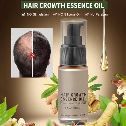 Fast hair growth essence oil hair loss treatment to help hair growth hair care 20ml hair nutrient solution scalp care MPwell