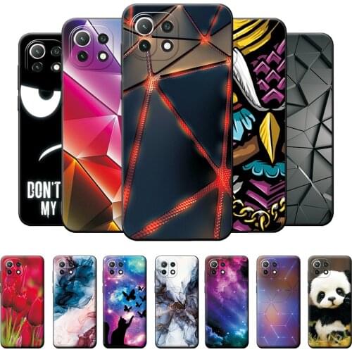 Adlikeme Xiaomi Mi 11 Phone Cases