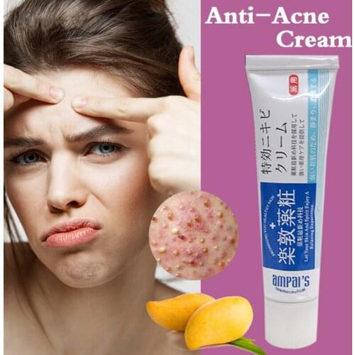 Anti-acne cream treatment cream blackhead acne cream repair gel oil control shrink pores scar facial care whitening skin 30g