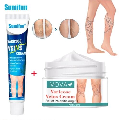 2Types Varicose Veins Treatment Ointmnet Vasculitis Phlebitis Cream Thigh Spider Removal Pain Relief Anti Swelling Plaster