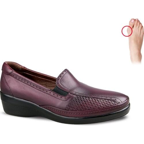 CEYO 9920-32 Women Shoes Shoe Casual Genuine Leather Burgundy Red Brown Black Hallux Valgus Summer