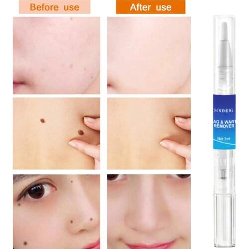 Маски для шеи OEDO China At AliExpress