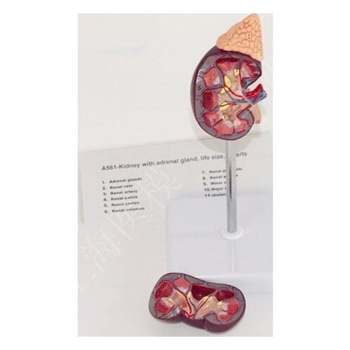 Kidney model with adrenal gland naturally large kidney urinary system structure model free shipping