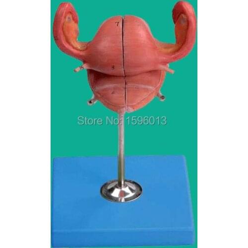 Anatomical Uterus Model, detachable Uterus model