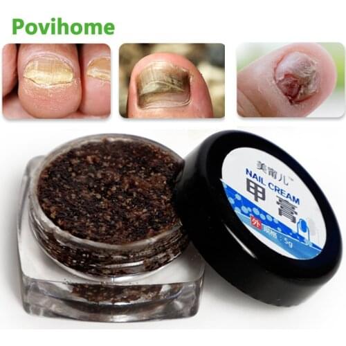 1pcs Nail Repair Ointment Toe Foot Care Anti-Fungal Cream Nail Treatment Pen Onychomycosis Anti Infection Paronychia Repair Tool