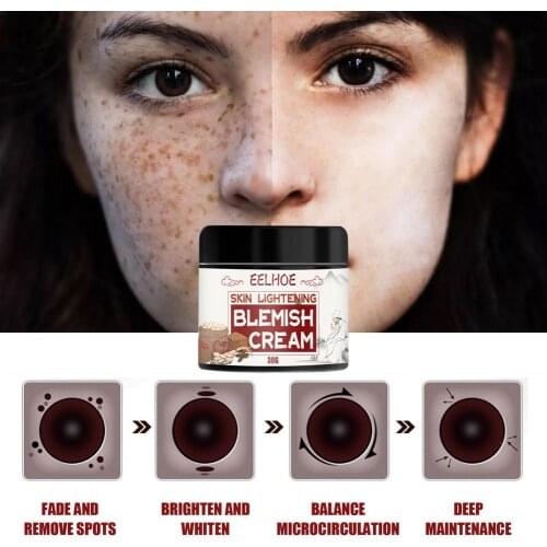 Effective Whitening Freckle Cream 50g Remove Spot Pigment Melanin Dark Spots Whitening Moisturizing Cream Skin Care