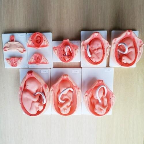 10 pcs Pregnancy development process model Embryonic uterus Fetus model