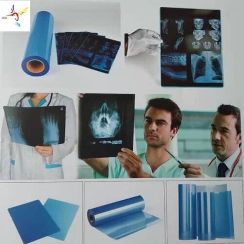 Blue Inkjet Medical Film for EPSON CANON HP and All Kinds of Inkjet Printer Used As X-Ray CT CR DR MR and PET-CT