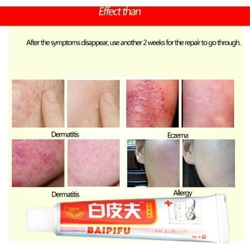 Baipifu Original Body Cream good for skin health ease hot itchy pain Without Retail Box Hot Selling With Box Bady Cream Skin